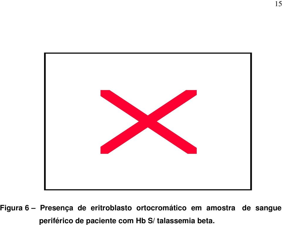 amostra de sangue periférico