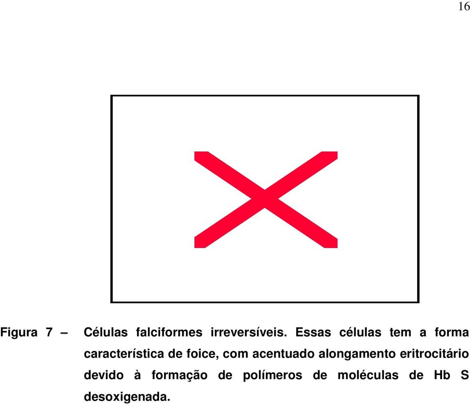 com acentuado alongamento eritrocitário devido à