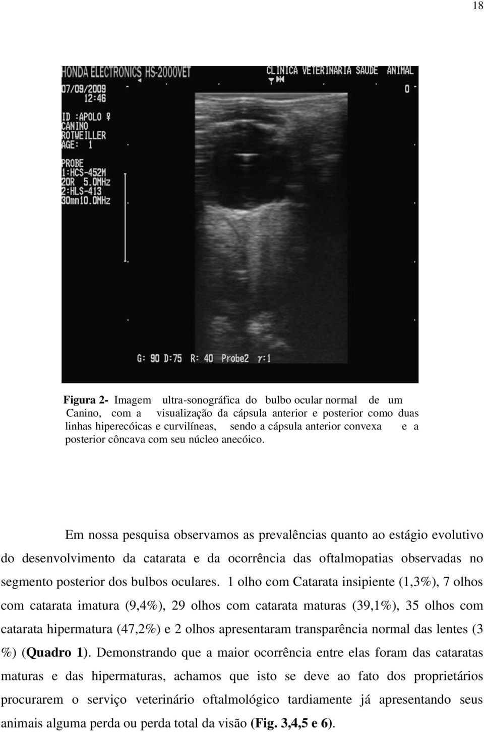 Em nossa pesquisa observamos as prevalências quanto ao estágio evolutivo do desenvolvimento da catarata e da ocorrência das oftalmopatias observadas no segmento posterior dos bulbos oculares.