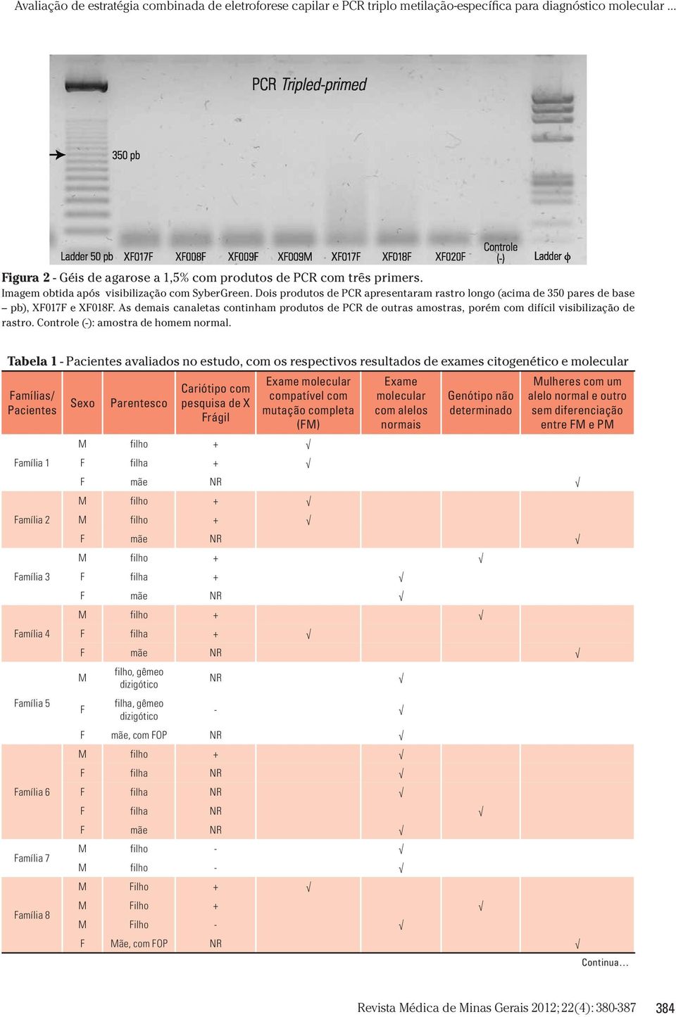 As demais canaletas continham produtos de PCR de outras amostras, porém com difícil visibilização de rastro. Controle (-): amostra de homem normal.