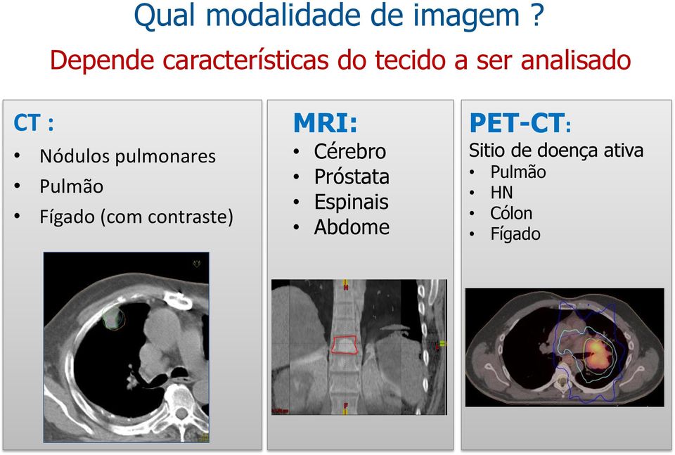 Nódulos pulmonares Pulmão Fígado (com contraste) MRI: