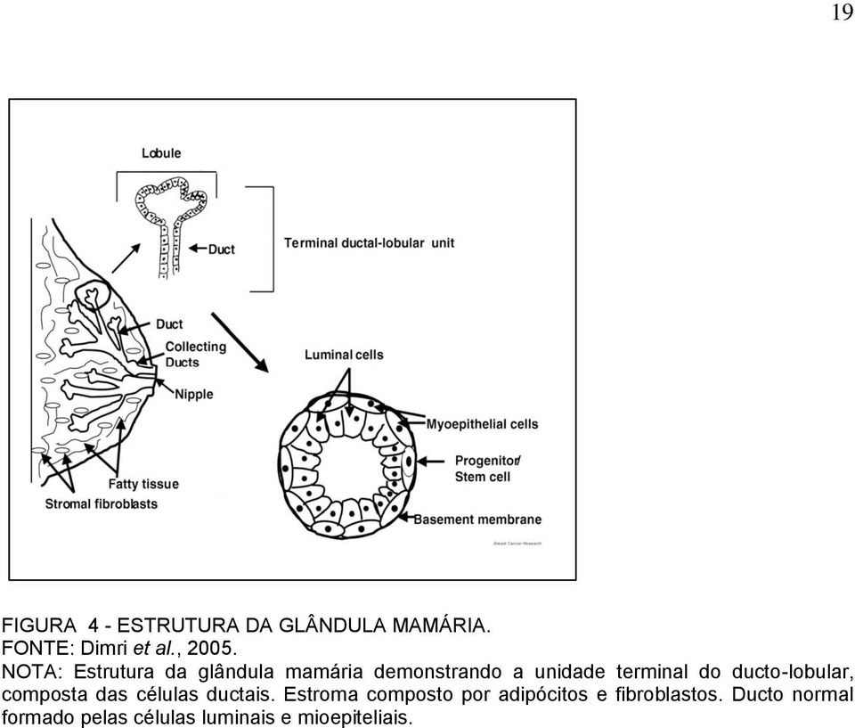 ducto-lobular, composta das células ductais.