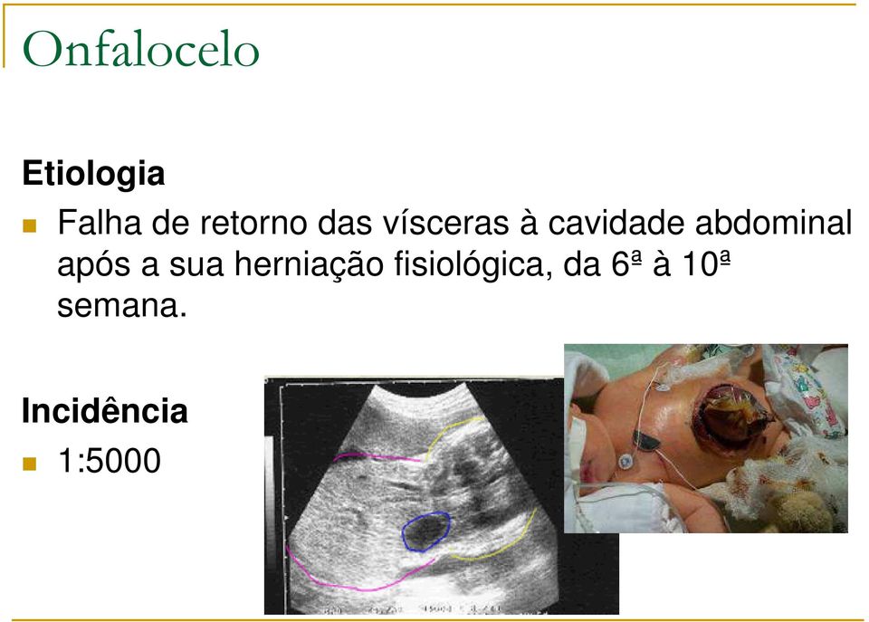 abdominal após a sua herniação