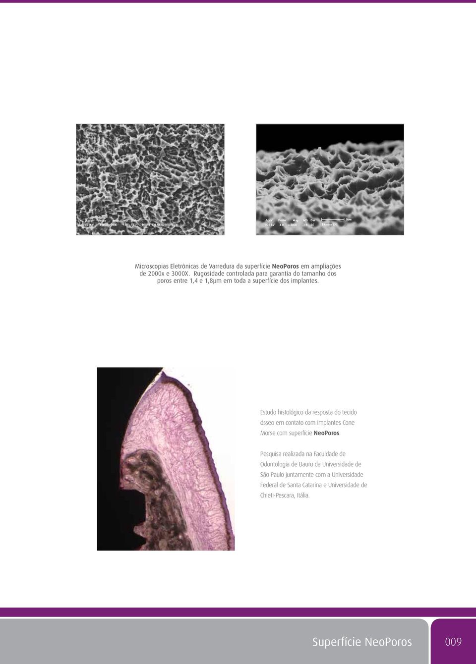 Estudo histológico da resposta do tecido ósseo em contato com Implantes Cone Morse com superfície NeoPoros.