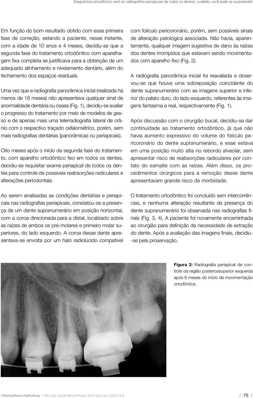 nivelamento dentário, além do fechamento dos espaços residuais.