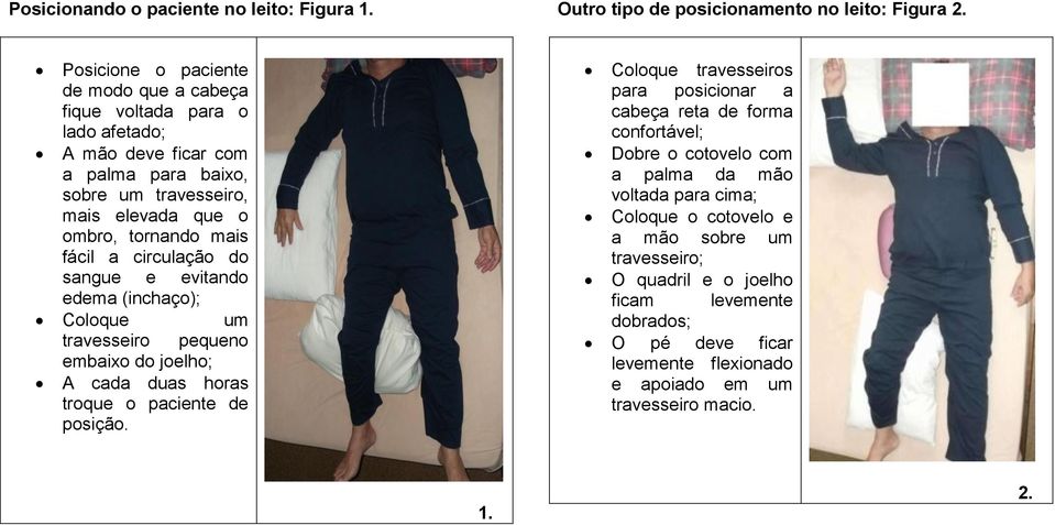 fácil a circulação do sangue e evitando edema (inchaço); Coloque um travesseiro pequeno embaixo do joelho; A cada duas horas troque o paciente de posição.