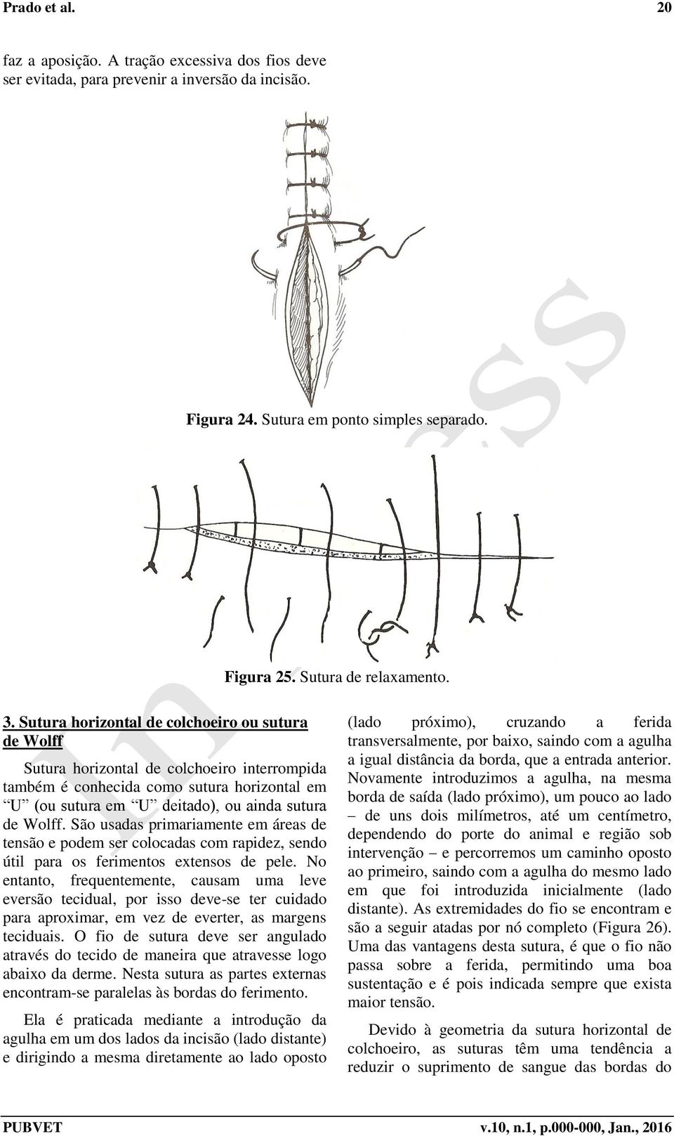 São usadas primariamente em áreas de tensão e podem ser colocadas com rapidez, sendo útil para os ferimentos extensos de pele.