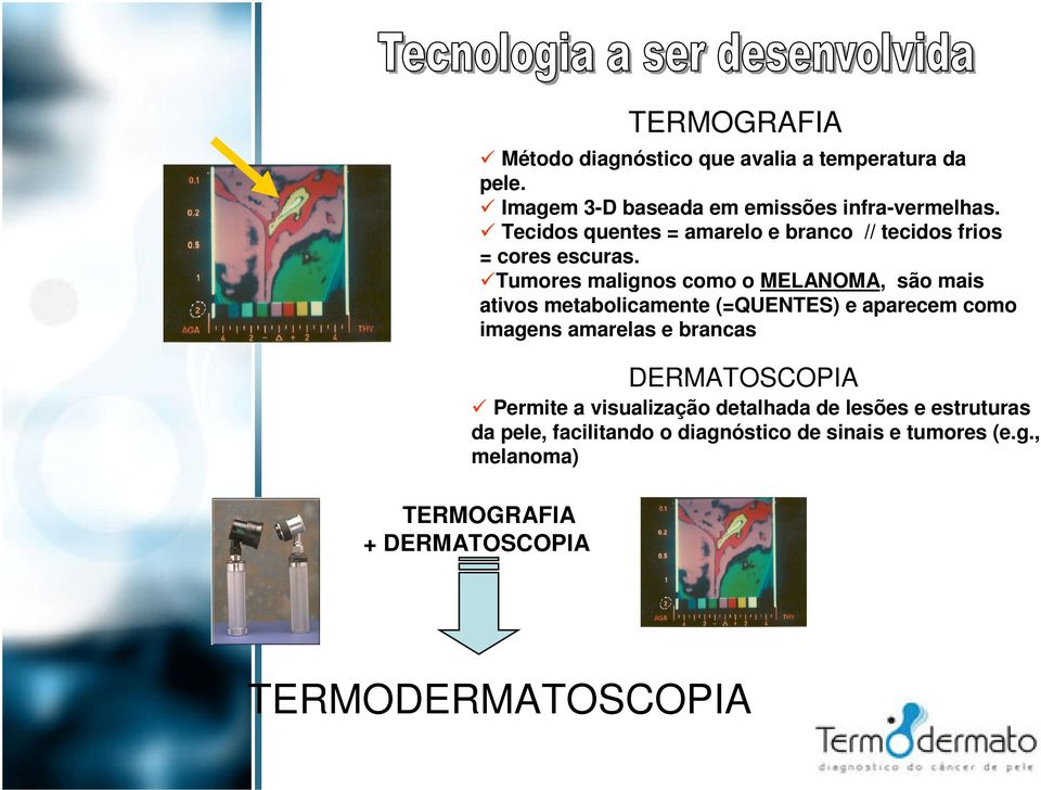 Tumores malignos como o MELANOMA, são mais ativos metabolicamente (=QUENTES) e aparecem como imagens amarelas e brancas