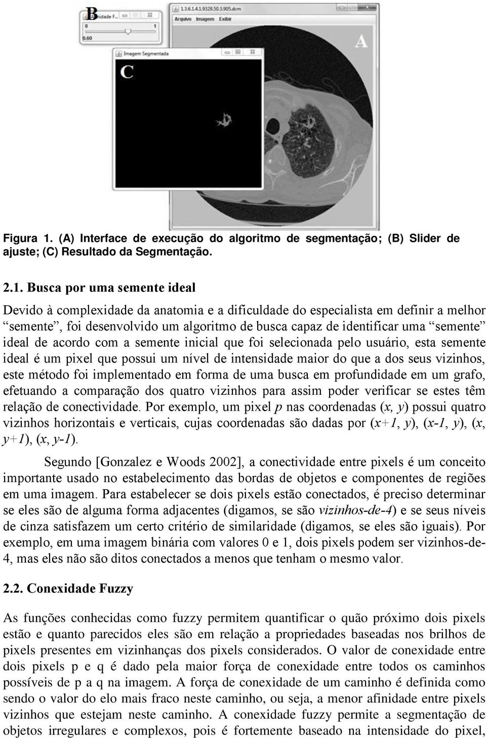 Busca por uma semente ideal Devido à complexidade da anatomia e a dificuldade do especialista em definir a melhor semente, foi desenvolvido um algoritmo de busca capaz de identificar uma semente