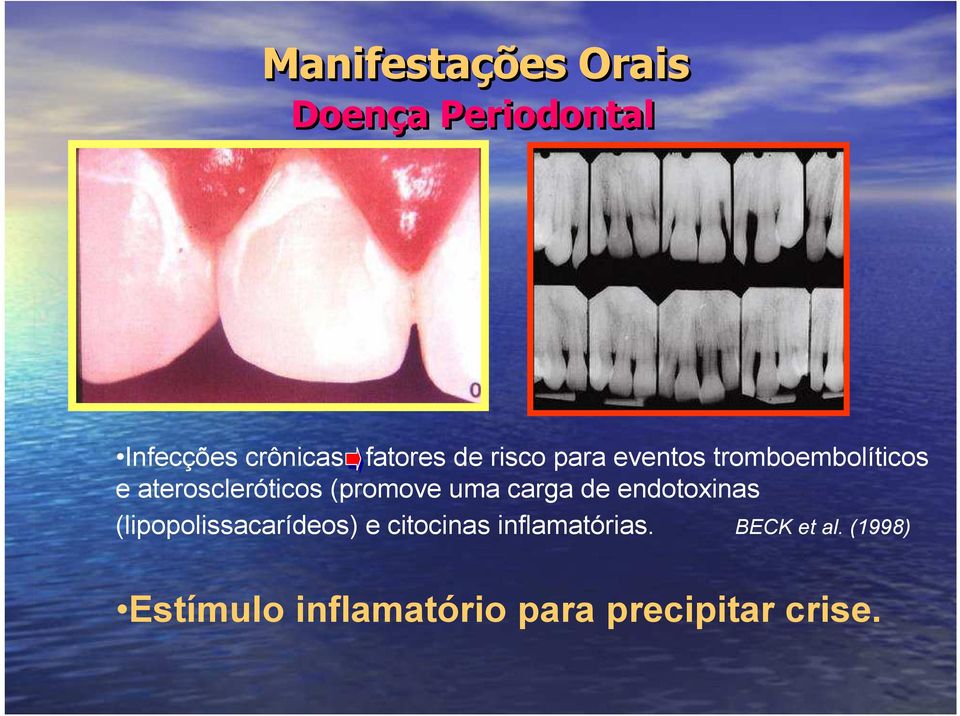 uma carga de endotoxinas (lipopolissacarídeos) e citocinas