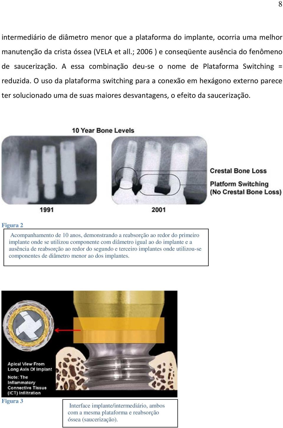 O uso da plataforma switching para a conexão em hexágono externo parece ter solucionado uma de suas maiores desvantagens, o efeito da saucerização.