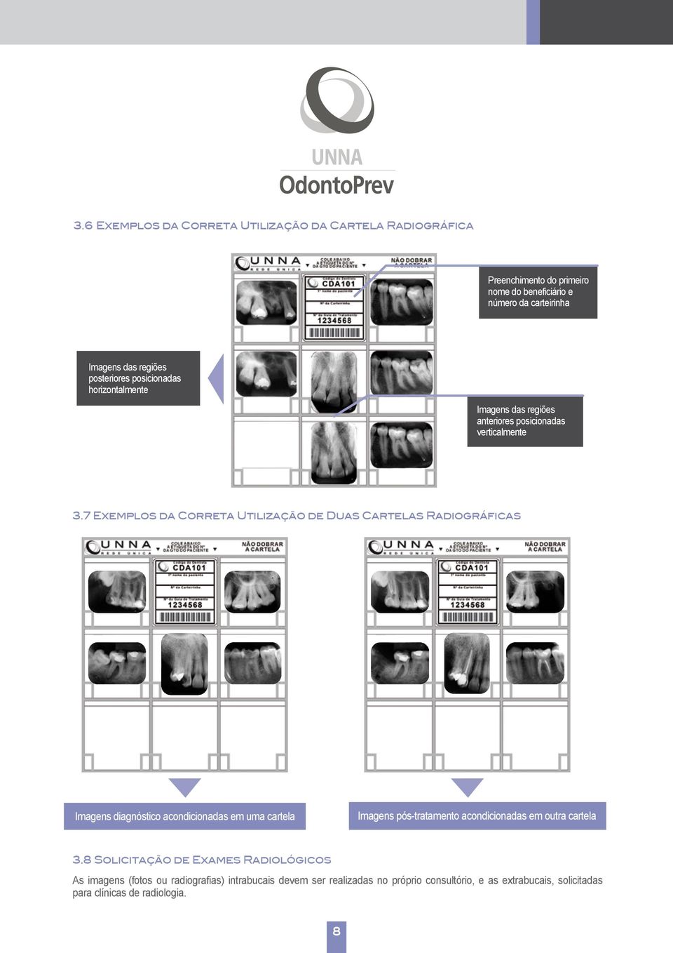 7 Exemplos da Correta Utilização de Duas Cartelas Radiográficas Imagens diagnóstico acondicionadas em uma cartela Imagens pós-tratamento acondicionadas