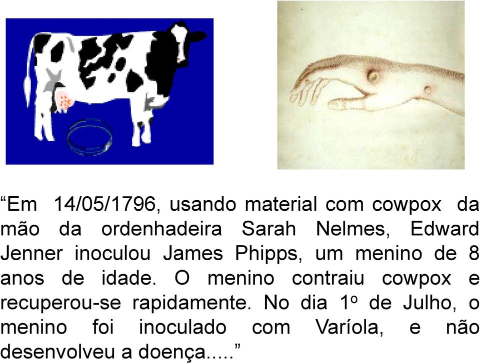 idade. O menino contraiu cowpox e recuperou-se rapidamente.