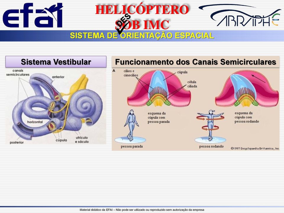 Vestibular