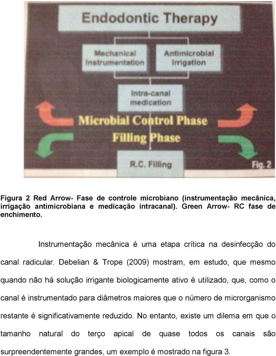 Debelian & Trope (2009) mostram, em estudo, que mesmo quando não há solução irrigante biologicamente ativo é utilizado, que, como o canal é instrumentado para