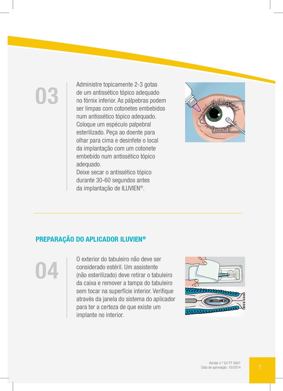 Deixe secar o antissético tópico durante 30-60 segundos antes da implantação de ILUVIEN. PREPARAÇÃO DO APLICADOR ILUVIEN 04 O exterior do tabuleiro não deve ser considerado estéril.