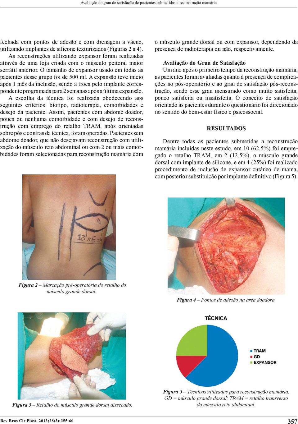 O tamanho de expansor usado em todas as pacientes desse grupo foi de 500 ml.