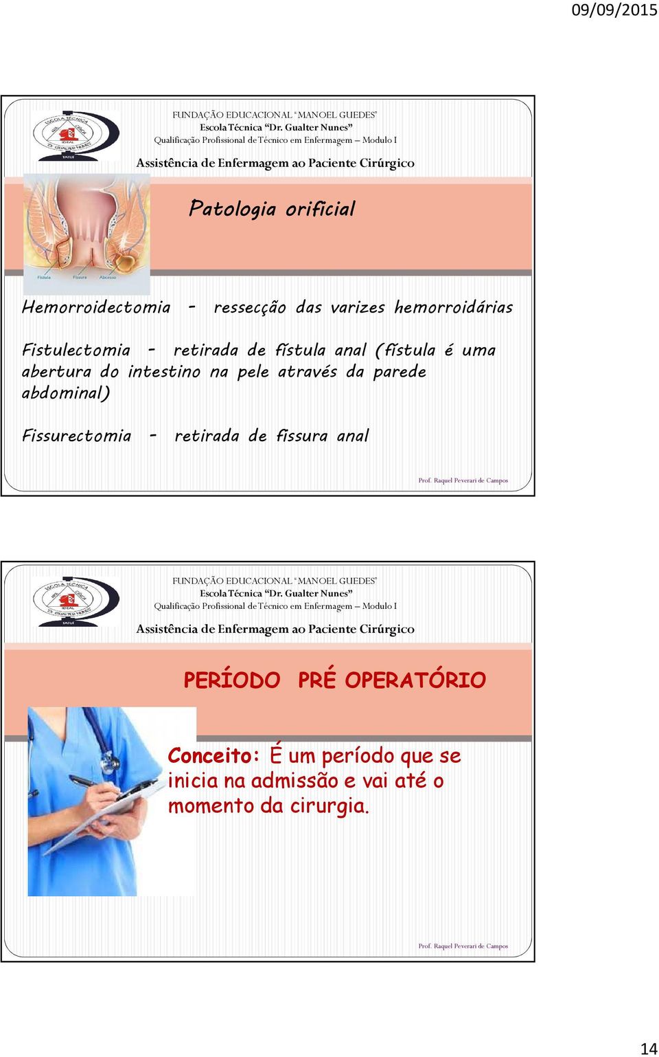 pele através da parede abdominal) Fissurectomia - retirada de fissura anal PERÍODO