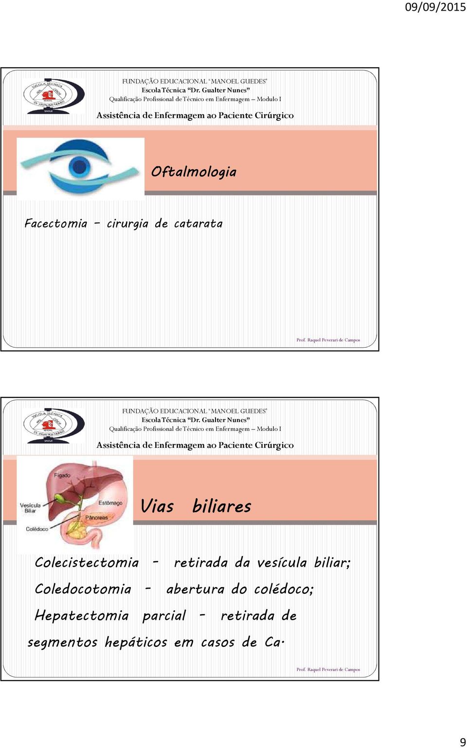 biliar; Coledocotomia - abertura do colédoco;