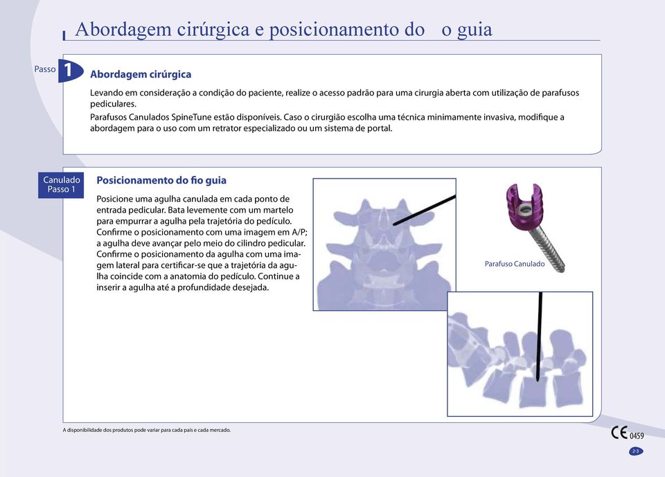 Caso o cirurgião escolha uma técnica minimamente invasiva, modifique a abordagem para o uso com um retrator especializado ou um sistema de portal.