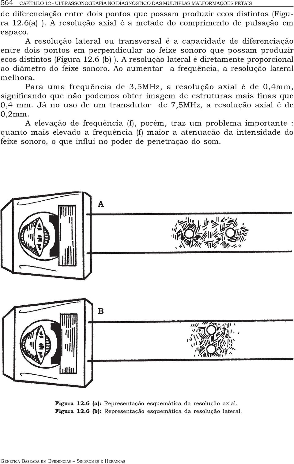 A resolução lateral ou transversal é a capacidade de diferenciação entre dois pontos em perpendicular ao feixe sonoro que possam produzir ecos distintos (Figura 12.6 (b) ).