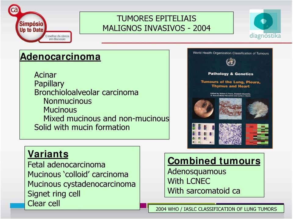 Combined tumours Fetal adenocarcinoma Mucinous colloid carcinoma Adenosquamous Mucinous