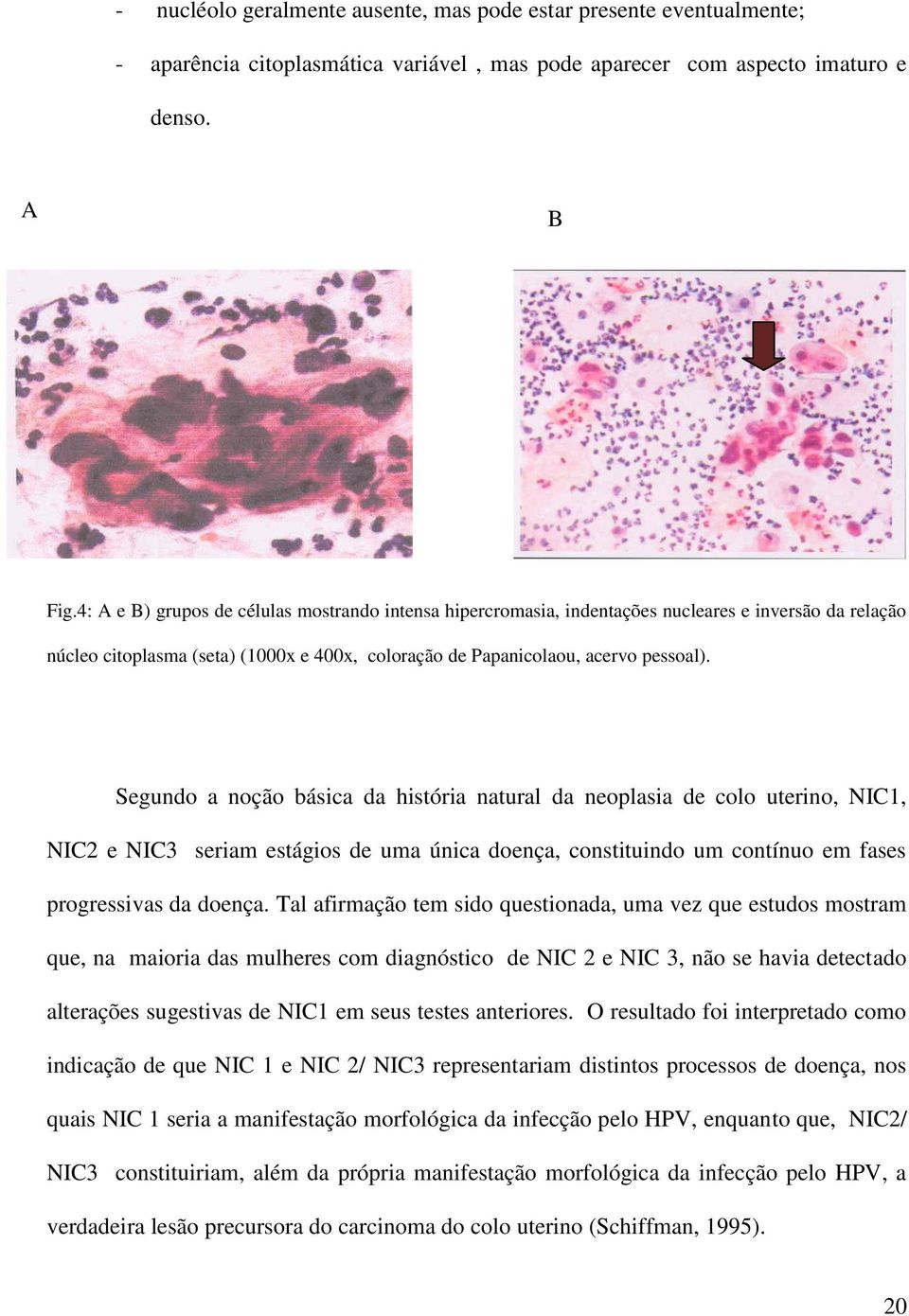 Segundo a noção básica da história natural da neoplasia de colo uterino, NIC1, NIC2 e NIC3 seriam estágios de uma única doença, constituindo um contínuo em fases progressivas da doença.