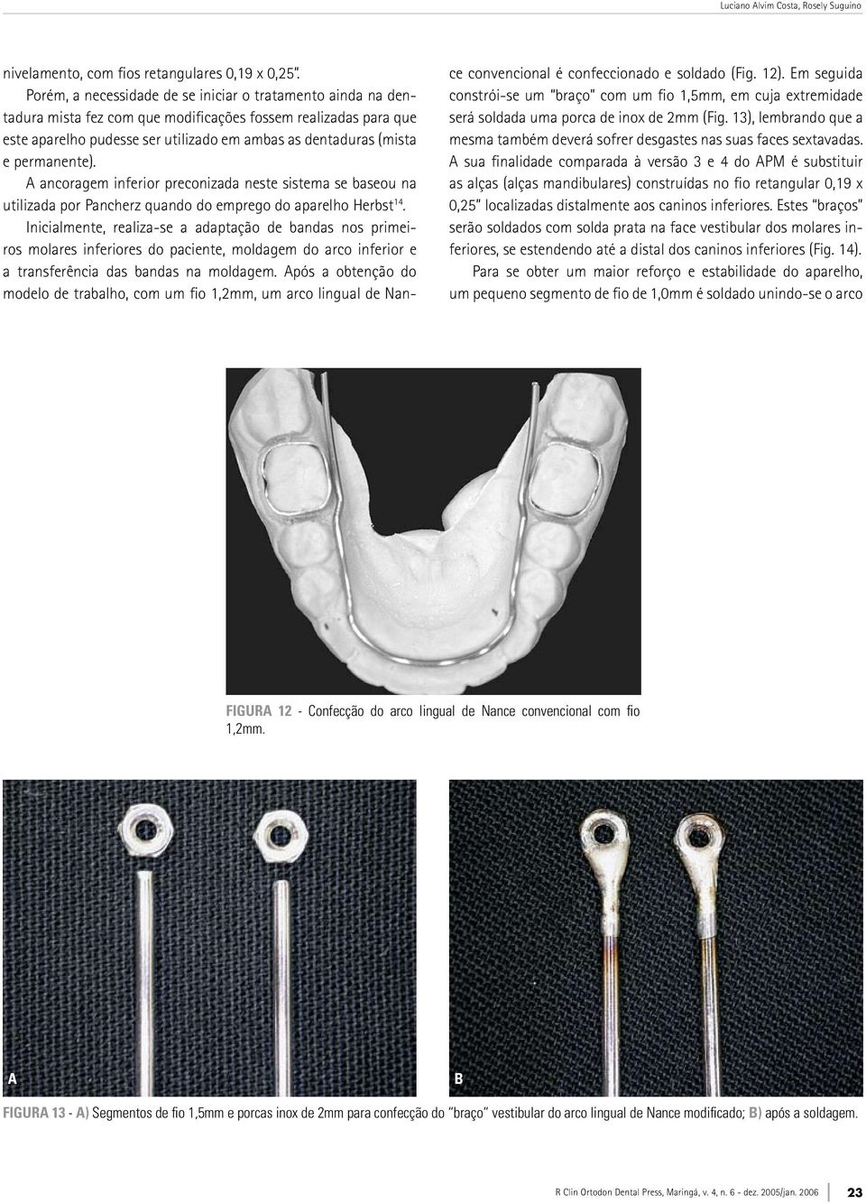 permanente). ancoragem inferior preconizada neste sistema se baseou na utilizada por Pancherz quando do emprego do aparelho Herbst 14.