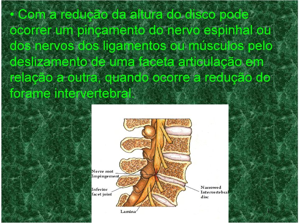 ou músculos pelo deslizamento de uma faceta articulação em