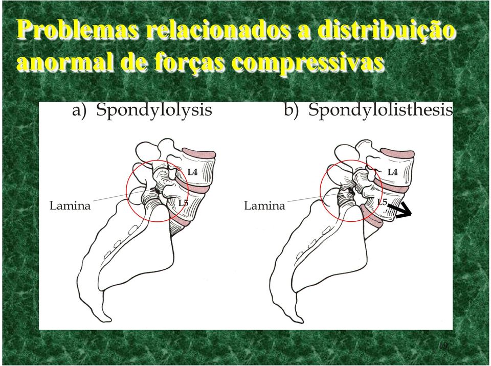 distribuição