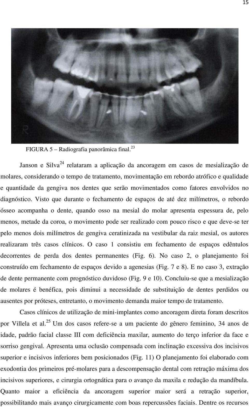 nos dentes que serão movimentados como fatores envolvidos no diagnóstico.