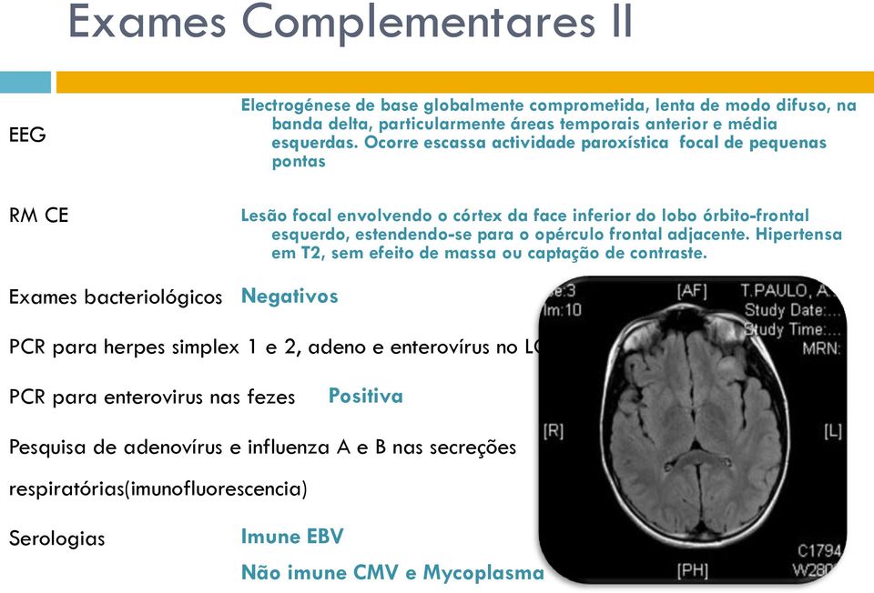 Ocorre escassa actividade paroxística focal de pequenas pontas Lesão focal envolvendo o córtex da face inferior do lobo órbito-frontal esquerdo, estendendo-se para o opérculo