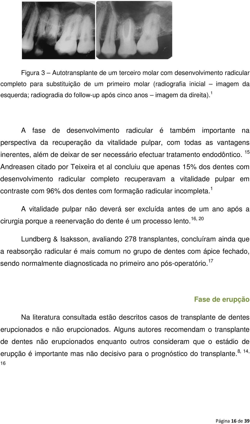 1 A fase de desenvolvimento radicular é também importante na perspectiva da recuperação da vitalidade pulpar, com todas as vantagens inerentes, além de deixar de ser necessário efectuar tratamento