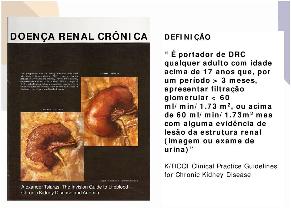 73m2 mas com alguma evidência de lesão da estrutura renal (imagem ou exame de urina) K/DOQI Clinical