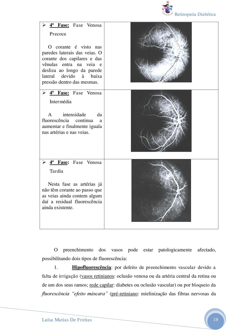 4ª Fase: Fase Venosa Intermédia A intensidade da fluorescência continua a aumentar e finalmente iguala nas artérias e nas veias.