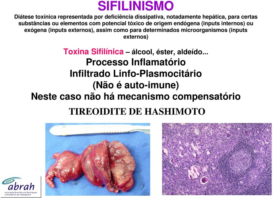 assim como para determinados microorganismos (inputs externos) Toxina Sifilínica álcool, éster, aldeído.