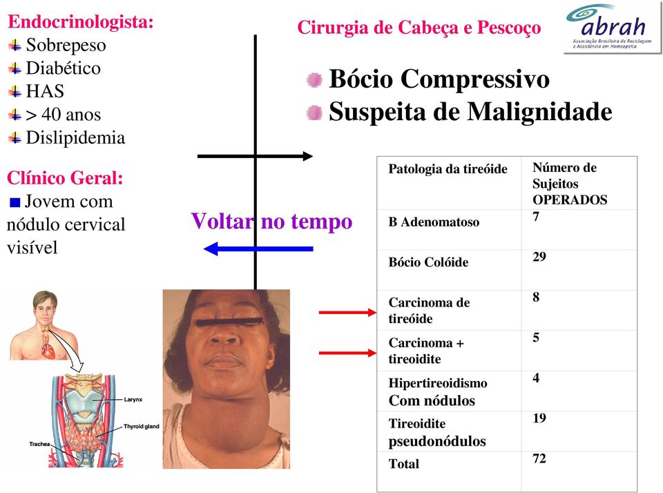 tempo Patologia da tireóide Número de Sujeitos OPERADOS B Adenomatoso 7 Bócio Colóide 29 Carcinoma