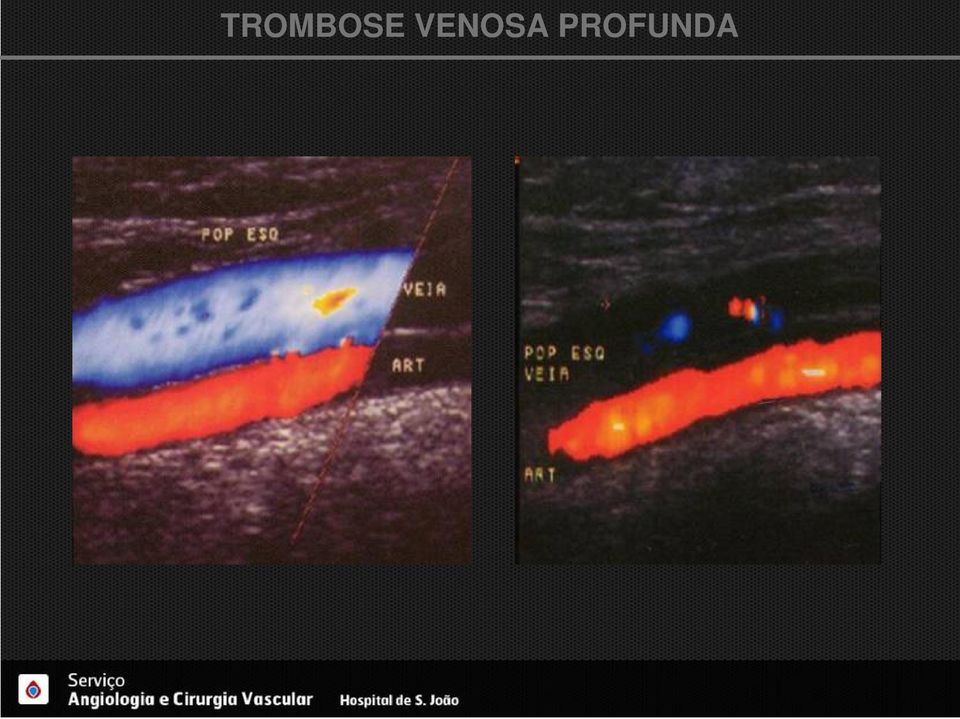 PROFUNDA