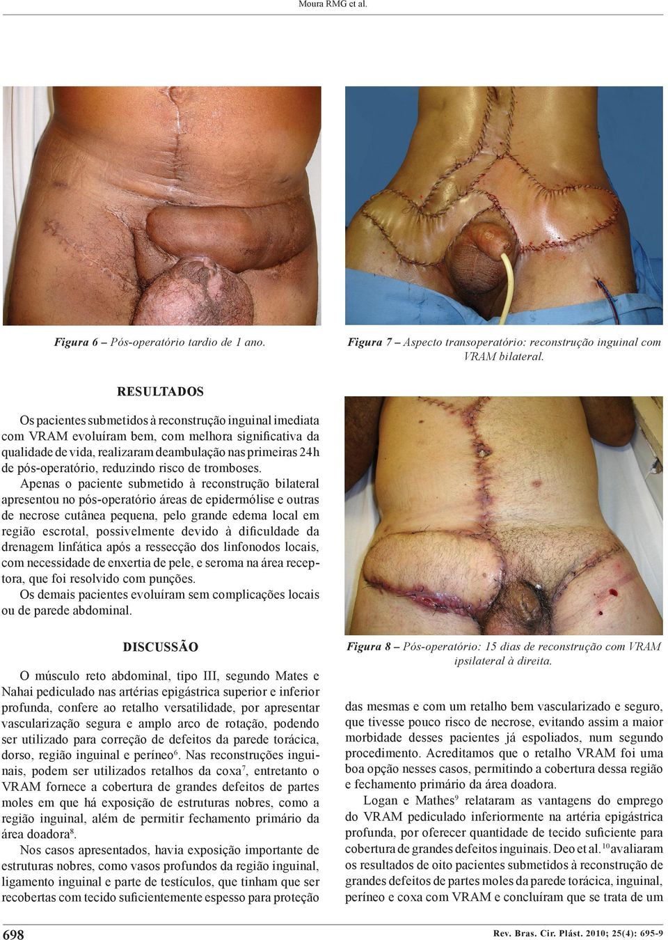 reduzindo risco de tromboses.