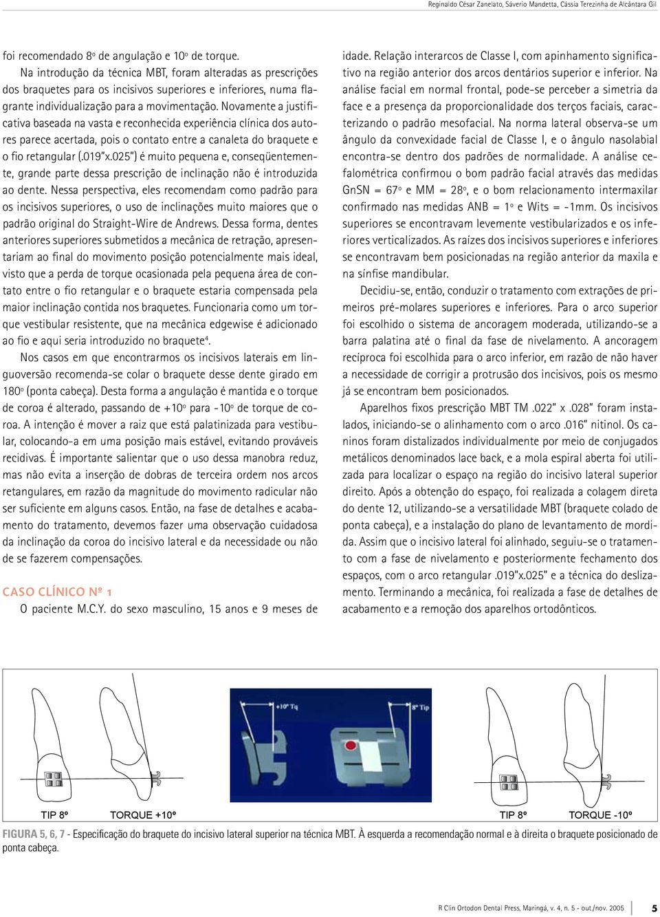 Novamente a justificativa baseada na vasta e reconhecida experiência clínica dos autores parece acertada, pois o contato entre a canaleta do braquete e o fio retangular (.019 x.