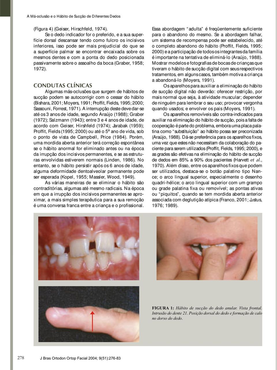 sobre os mesmos dentes e com a ponta do dedo posicionada passivamente sobre o assoalho da boca (Graber, 1958; 1972).