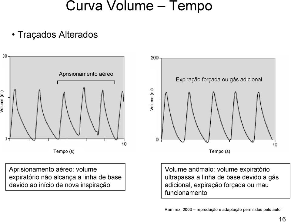 devido ao início de nova inspiração Volume anômalo: volume expiratório ultrapassa a linha de base devido a