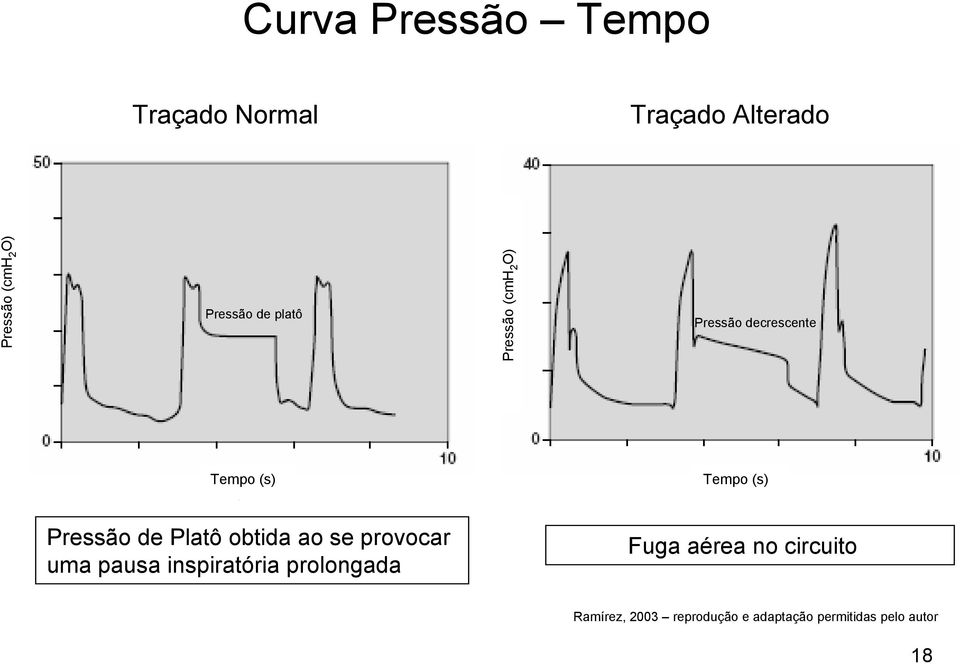 Pressão de Platô obtida ao se provocar uma pausa inspiratória prolongada