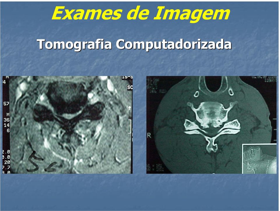 Tomografia