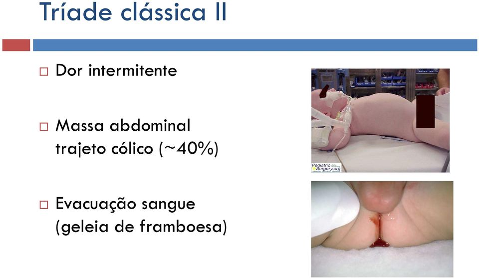 abdominal trajeto cólico