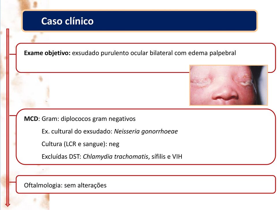 cultural do exsudado: Neisseria gonorrhoeae Cultura (LCR e sangue):