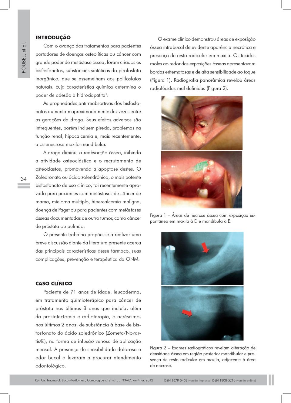 pirofosfato inorgânico, que se assemelham aos polifosfatos naturais, cuja característica química determina o poder de adesão à hidroxiapatita 1.