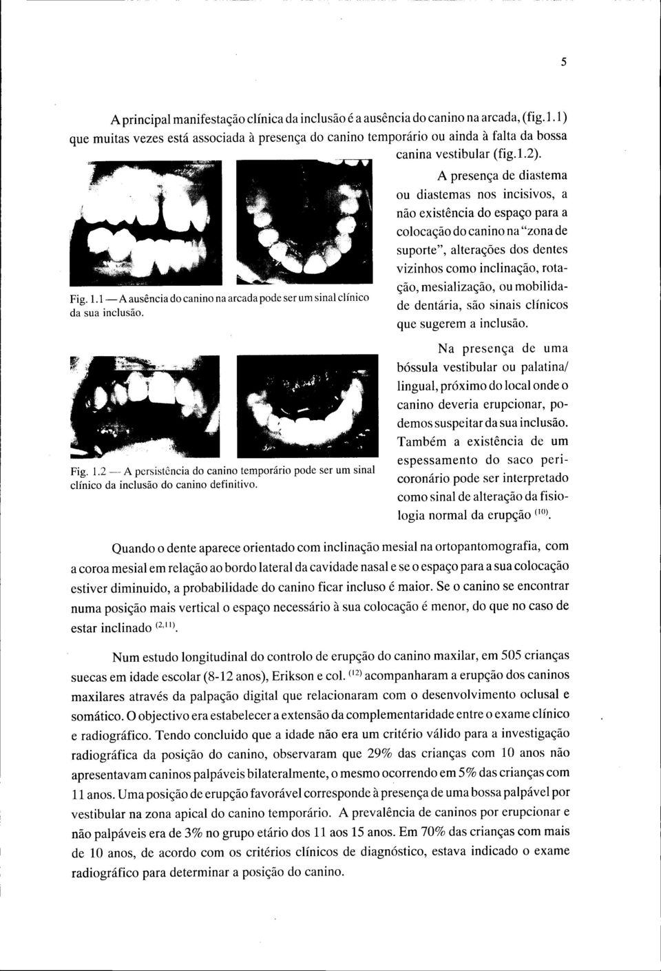 A presença de diastema ou diastemas nos incisivos, a não existência do espaço para a colocação do canino na "zona de suporte", alterações dos dentes vizinhos como inclinação, rotação, mesialização,