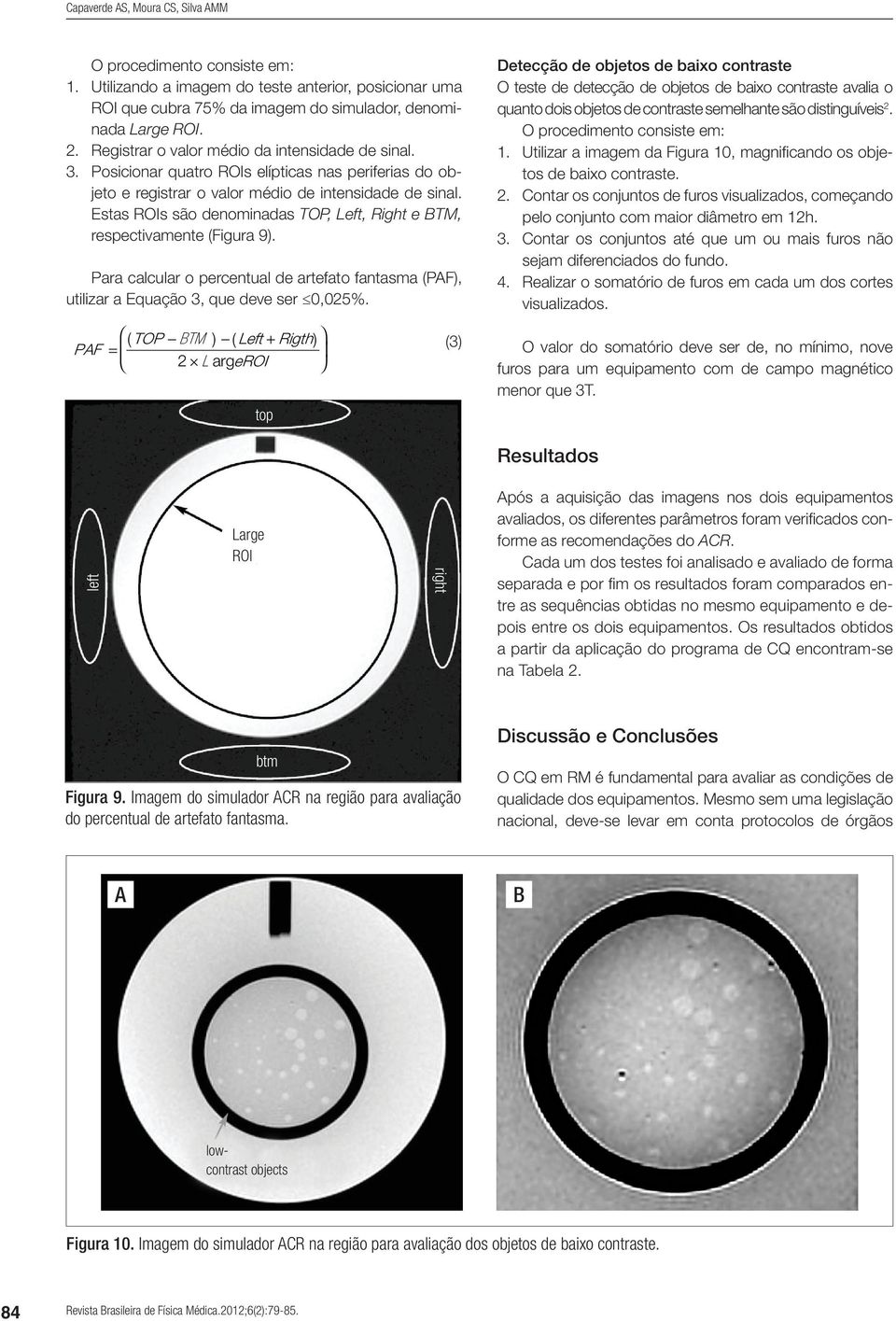 Estas ROIs são denominadas TOP, Left, Right e TM, respectivamente (Figura 9). Para calcular o percentual de artefato fantasma (PF), utilizar a Equação 3, que deve ser 0,025%.