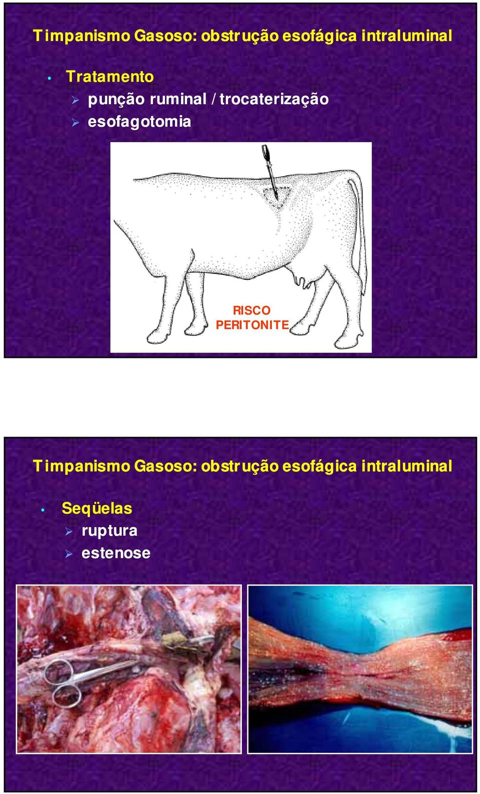trocaterização esofagotomia RISCO PERITONITE 